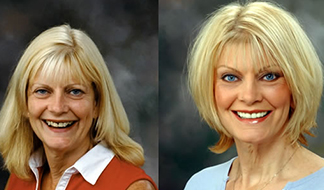Drs. Kenneth   Robin Rawlinson, LLC | Veneers, Dental Fillings and Extractions