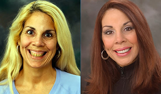 Drs. Kenneth   Robin Rawlinson, LLC | Extractions, Sleep Apnea and Dentures