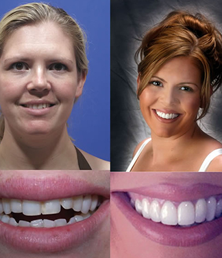 Drs. Kenneth   Robin Rawlinson, LLC | Veneers, Dental Fillings and Teeth Whitening