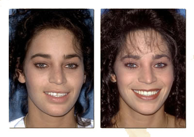 Drs. Kenneth   Robin Rawlinson, LLC | Dentures, Veneers and Preventative Program