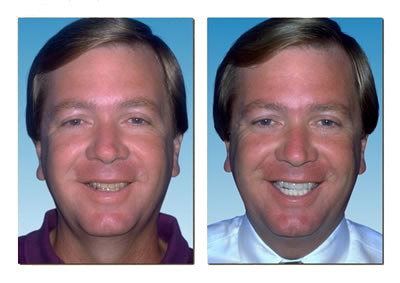 Drs. Kenneth   Robin Rawlinson, LLC | Oral Exams, Extractions and Veneers