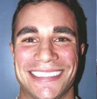 Drs. Kenneth   Robin Rawlinson, LLC | Root Canals, Oral Exams and Extractions