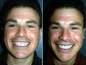 Drs. Kenneth Robin Rawlinson, LLC | Periodontal Treatment, Oral Exams and Dental Bridges