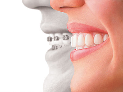 Drs. Kenneth   Robin Rawlinson, LLC | Sleep Apnea, Preventative Program and Dental Fillings