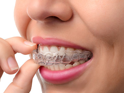 Drs. Kenneth   Robin Rawlinson, LLC | Extractions, Preventative Program and Root Canals
