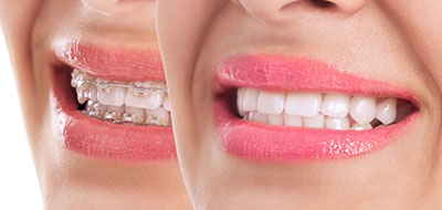 Drs. Kenneth   Robin Rawlinson, LLC | Oral Exams, Sleep Apnea and Root Canals