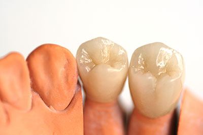Drs. Kenneth   Robin Rawlinson, LLC | Dental Fillings, Preventative Program and Sleep Apnea