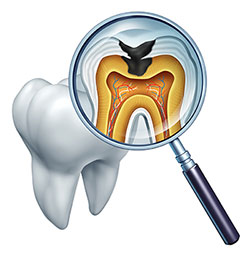 Drs. Kenneth   Robin Rawlinson, LLC | Teeth Whitening, Periodontal Treatment and Veneers