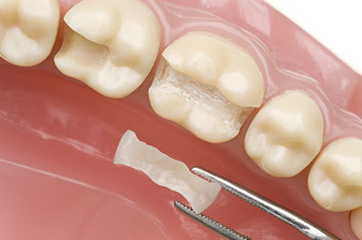 Drs. Kenneth   Robin Rawlinson, LLC | Teeth Whitening, Extractions and Dental Fillings