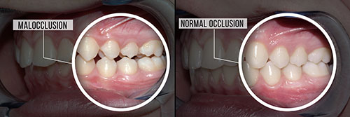 Drs. Kenneth   Robin Rawlinson, LLC | Root Canals, Dental Bridges and Crowns