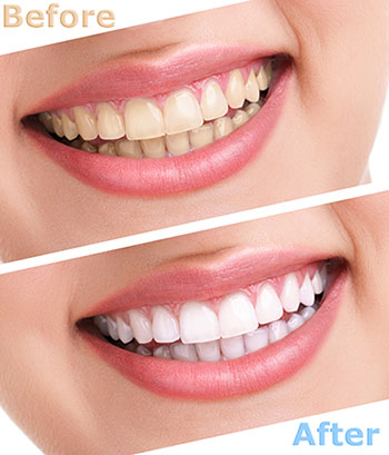 Drs. Kenneth   Robin Rawlinson, LLC | Root Canals, Extractions and Dental Fillings