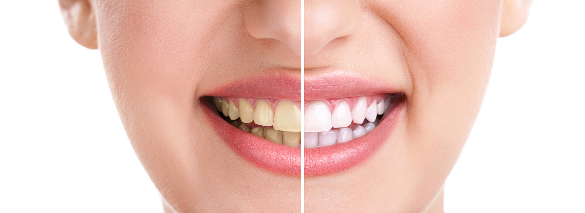 Drs. Kenneth   Robin Rawlinson, LLC | Extractions, Root Canals and Oral Exams